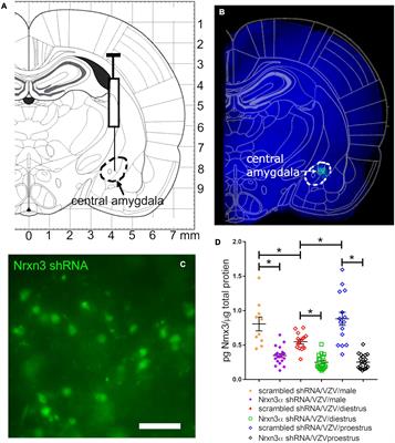 Sex Differences in the Role of Neurexin 3α in Zoster Associated Pain